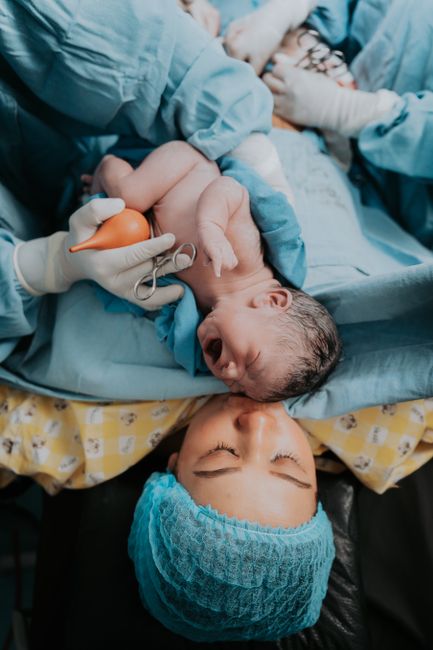 Nascita di un bambino durante un parto cesareo, con il neonato tenuto in braccio dal personale medico e la madre che lo guarda con affetto.