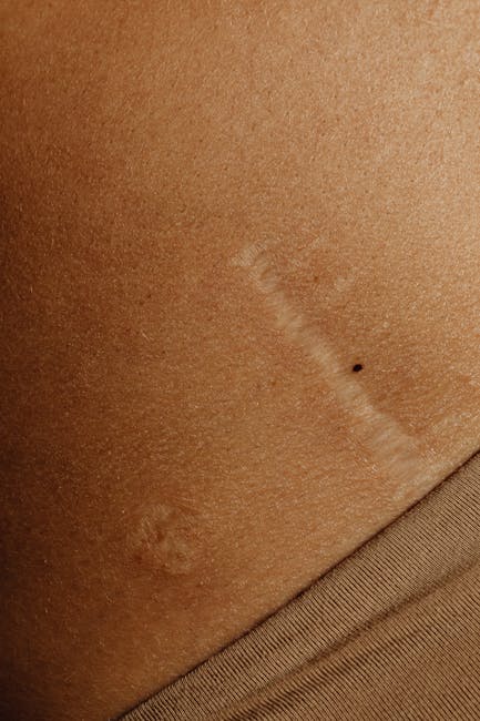 ICD 10: Unico e Fondamentale per il Settore Sanitario